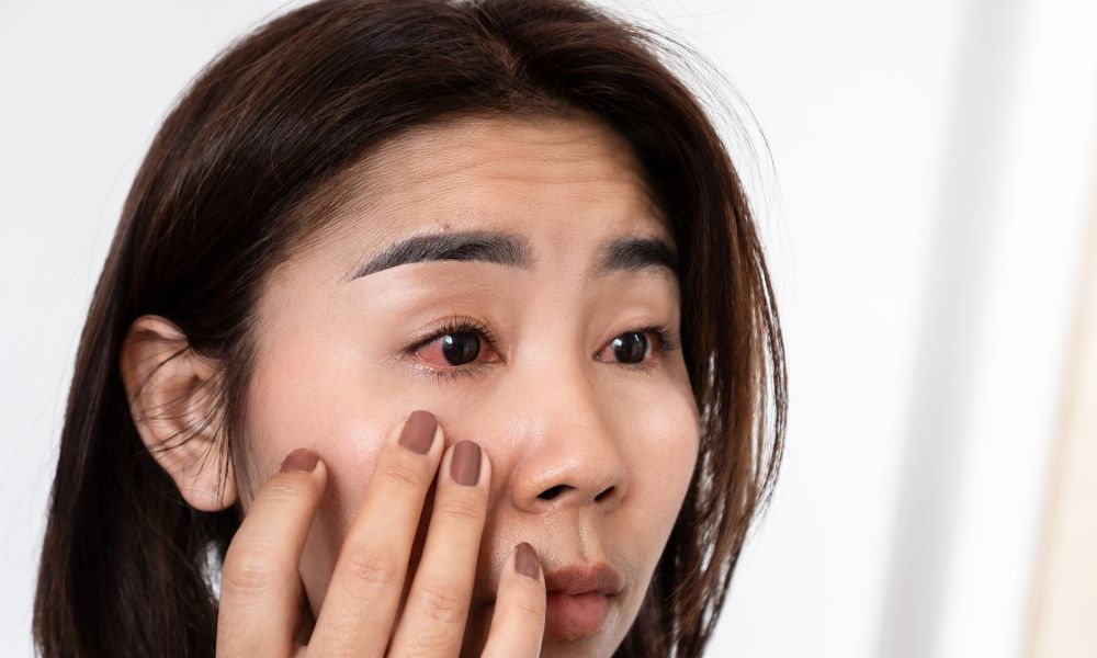 Safe And Soothing Eye Infection Remedies For All Ages
