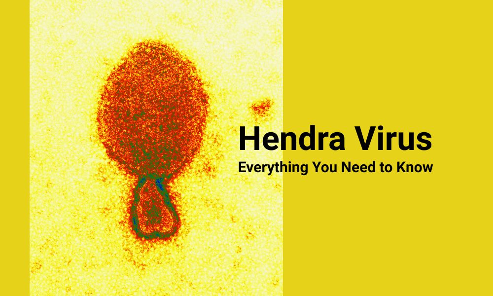 Everything to Know About Hendra virus