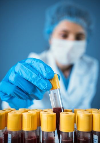 Doing blood analysis