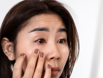 eye-infection-treatment Safe And Soothing Eye Infection Remedies For All Ages